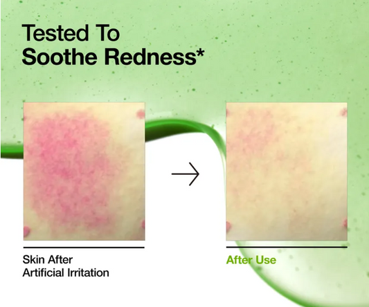 Anua- Suero calmante para el enrojecimiento con ácido azelaico 10% y ácido hialurónico, alivia el acné, la rosácea y la hiperpigmentación, mientras que el ácido hialurónico proporciona una hidratación duradera.