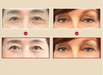 KSECRET SEOUL 1988 Crema de ojos: liposoma retiniano 4% + frijol fermentado, cuidado de arrugas, antienvejecimiento, elasticidad de la piel, pigmentación, brillo