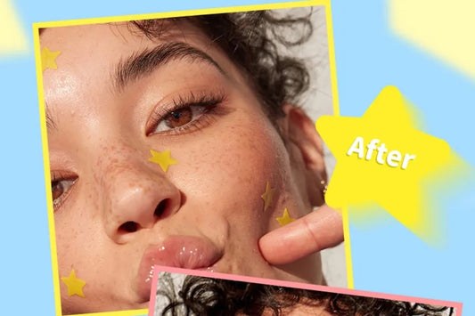 MLSMILE - Smile Star Pimple Patches - 4-5- color amarillo/ 40 parches