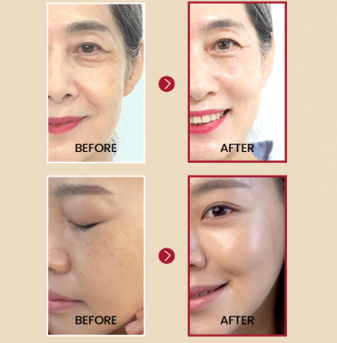 KSECRET | SEOUL 1988 Suero: Liposoma retinal 2% + 58% extracto de gingeng negro con retina, bakuchiol, vitamina C y 3 péptidos