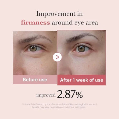 Medicube PDRN Pink Peptide Eye Cream 30ml es un tratamiento antiedad avanzado para el contorno de ojos que combina PDRN de salmón, péptidos, retinol y niacinamida para mejorar la firmeza, hidratar profundamente y reducir ojeras y líneas de expresión.