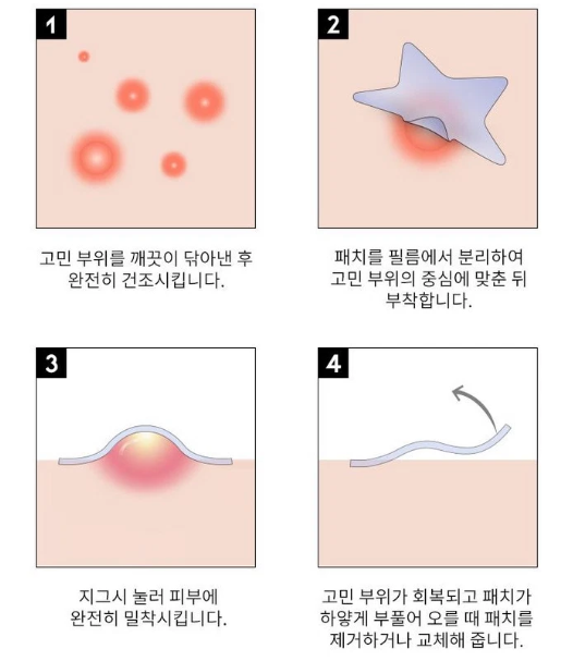 OOTD BEAUTY-Parche facial Star Spot para acné y granos, hidrocoloide, niacinamida y ceramida. 80 Parches