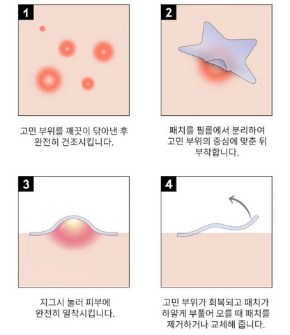 OOTD BEAUTY-Parche facial Star Spot para acné y granos, hidrocoloide, niacinamida y ceramida. 80 Parches